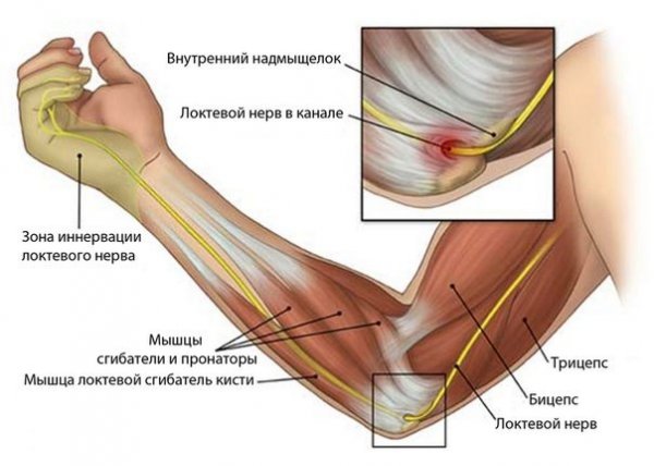 Спортивные травмы локтевого сустава